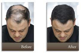 Regain Your Confidence With A Full Head Of Hair With Toppik Hair Fibers Hair Building Toppik Hairstyles For Thin Hair
