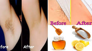 Normally, the papaya enzyme hinders the regrowth of hair that is both in male and females and that way permanently getting rid of your pubic hair. What Is The Best Way To Remove Pubic Hair Permanently