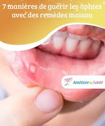 Epingle Sur Doudoune