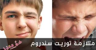 متلازمة توريت سندروم وأعراضها مثل النباح قول كلمات بذيئه الحركات الـ لاإراديه لنتعرف علي ط Tourettes Syndrome Syndrome Incoming Call Screenshot