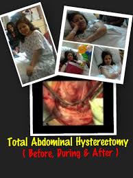 Total Abdominal Hysterectomy Chronicle Part 2 How Experiences Before During And After Operation Blendacalinaya S Blog