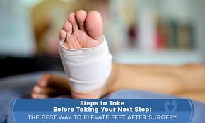 If you have stairs, trip and fall down them, twisting the ankle. Post Op Care The Best Way To Elevate Feet After Surgery Lounge Doctor