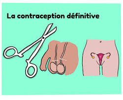 Traduction de se faire ligaturer les trompes en anglais. Contraception Definitive Parlons Sexualites