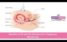 Image result for Chorionic Villus Sampling