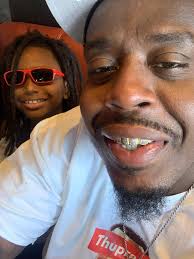 A local Kansas City father, now Needs A Prosthetic . This is 41 Year Old  Pierre Craddock. On July 4th … His Son Lit Up A Stick & A Half Dynamite, In