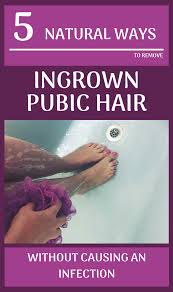 To trim it, gently pull the hair up, away from your body and then cut it back with small, sharp scissors, preferably clippers, along with some equipped with safety guards. Pin On Health