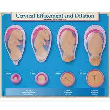 cervical effacement and dilation chart