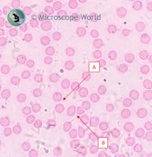 It is why human red blood cells, under the microscope, do not show any nucleus. Understanding Microscope Resolution By Viewing Blood Cells