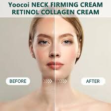 Retinol Anti Aging Face Moisturizer