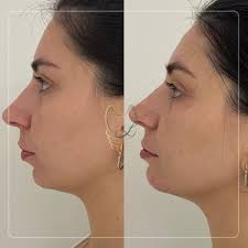 Letícia Finazzi De Almeida (@draleticiafinazzidealmeida) · Instagram 照片和视频