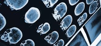 1 a disease caused by an uncontrolled division of abnormal cells in a part of the body. Dignity Health Treatment Terminology Remission Meaning Vs Cancer Free