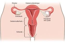 eierstockzysten ovarialzysten gesundheitsinformation de eierstockzysten zyste bauchspiegelung
