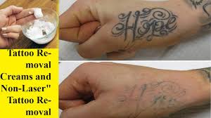 Tattoo removal with salt will give you a pretty nasty road rash. How I Remove Tattoos With Lemon Juice And Baking Soda At Home My Experience Lightening Youtube