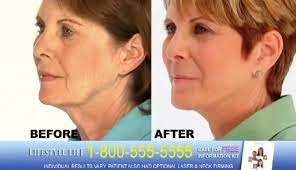 Your first day sets the tone for the next five weeks. One Hour Facelift Company Lifestyle Lift Abruptly Closes Considering Bankruptcy Consumerist