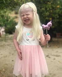 Hair color for brown eyes. Mexican American Parents Are Shocked After Giving Birth To A Blond Baby Girl With Light Skin Bored Panda