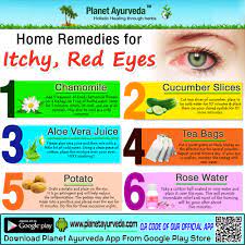 Top Home Remedies For Itchy Redeyes Charmomile Cucumberslices Aloeverajuice Patato Rosewater Te Home Remedies Remedies Remedies For Menstrual Cramps