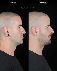 Daniel Roscher Ortognática Maxilofacial