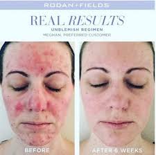 Hollie Coates-Hensley Rodan and Fields