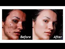 Pin On Retouching Skin