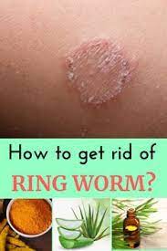 Dec 24, 2010 · one of the most common uses of h2o2 is as a wound sanitizer. George Ringworm Remedi Remediringwormgeorge Profile Pinterest