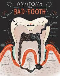 Pin By Sara Trejo On Odontologia Dental Anatomy Bad Teeth Teeth Art