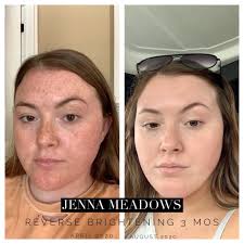 Rodan + Fields Executive Consultant, Lisa Steffens