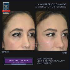 Dr. Salvatore Pacella