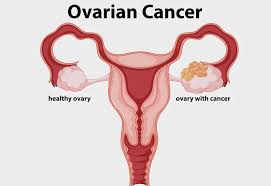 A synthetic form of progesterone that is similar to the hormone made naturally by the body. Is It Possible To Get Pregnant With One Ovary
