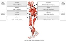 Deadlifts and squats are both amazing exercises that cause significant glute growth. Gluteal Amnesia E3 Rehab