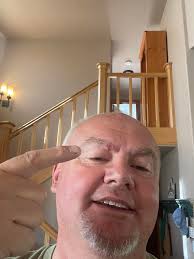 Shingles shot reminder for old classmates