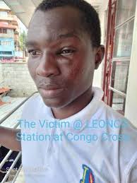 JUST IN! 😳 FBC lecturer and journalist Sheku Putka Kamara has blasted LAJ,  saying that his performance at the Amphitheater was disgraceful to his  office as the Peace Ambassador. He continued that