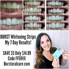 Home » teeth whitening » how to whiten teeth with braces on. Teeth Yellow After Braces Why And How To Fix It Toothbrush Life