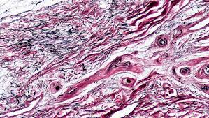 Connective tissue has large amounts of nonliving material between the cells. Connective Tissue Definition Types Functions Structure