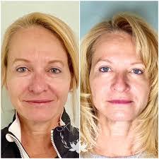 Kevin Biesinger's Instagram, Twitter & Facebook