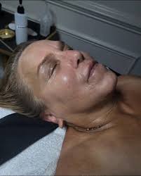 Eminence Skin Care Before and After