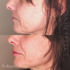 Shannon Begg BscN RN (@shannyb_rn) • Instagram photos and videos