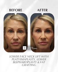 Carolina Facial Plastics