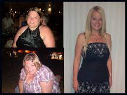 Was gastric bypass a mistake? Pin On Sleeve Surgery Wight Lost