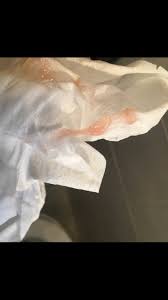 At 7 weeks pregnant, your baby is a little more than 1/3 of an inch long. Pink Mucus 7 Weeks Pregnant Implantation Bleeding Warning Tmi Pic Babycenter Starting In The Early Weeks Of Pregnancy The Expanding Uterus Presses On Your Bladder Causing You To Pee Ompz Ka