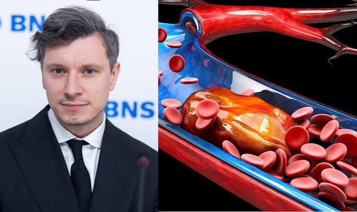 Кардиолог предупреждает: у трети людей тромбы образуются без видимой причины. Какие симптомы нельзя игнорировать? - Delfi RU