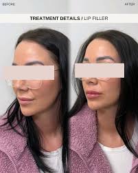 Jackie Spagnuolo, AG-NP (@beautynursenyc) • Instagram photos and videos