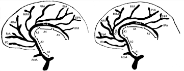 Maybe you would like to learn more about one of these? The Different Configurations Of The Anterior Cerebral Artery A Cma Is Download Scientific Diagram