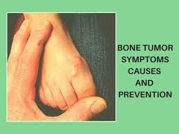 Pain is usually the first symptom of bone cancer. Health Feed Health Tips Fitness Tips And Diet Tips Doctoriduniya