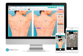Because it shows a history of changes to your skin over time, mole mapping can also help dermatologists diagnose melanoma and skin cancer earlier. Skin And Mole Checks High Street Medical Clinic