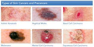 Check spelling or type a new query. Capella Blog Post Featuring Dr Munavalli Dermatology Laser Vein Specialists Of The Carolinas