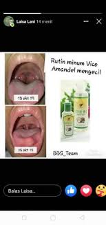 Check spelling or type a new query. Bisa Cod Vico Sr12 250ml Sejuta Manfaat Aman Untuk Usia Bayi 0 Bulan Sampai Dewasa Shopee Indonesia