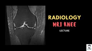 Use the mouse to scroll or the arrows. Mri Knee Detailed Explanation Radiology Lecture Youtube