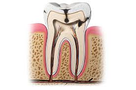 Finding an emergency dental office near me. Emergency Dentistry Nobel Dental Care