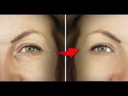 Prenez Une Photo Avant D Utiliser Cette Creme Et Prenez En Une Autre Apres L Avoir Utilisee Youtube Masques Faits Maison Belle Peau Soin Cheveux