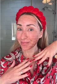 When to Wash Face After Co2